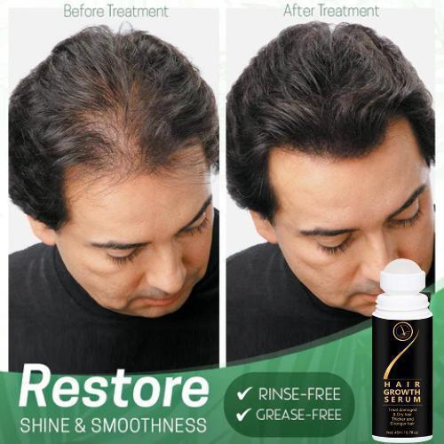 Hair Serum for Hair Growth